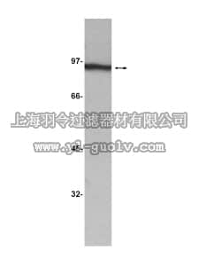 merck millipore,默克密理博,05-613,Anti-β-Catenin Antibody, clone 2H4A7
