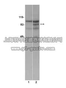merck millipore,默克密理博,05-618,Anti-WAVE1/Scar1 Antibody, clone 84.79