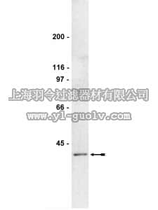 merck millipore,默克密理博,05-641,Anti-BRAF35 Antibody, clone 4.21