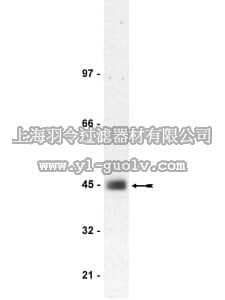 merck millipore,默克密理博,05-644,Anti-CAR Antibody, clone RmcB