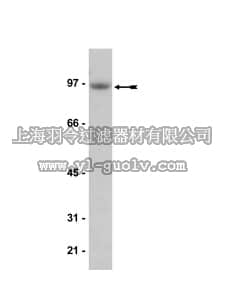merck millipore,默克密理博,05-656,Anti-IGF-IR Antibody, clone JBW902