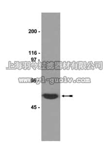 merck millipore,默克密理博,05-661,Anti-β-Tubulin Antibody, clone AA2