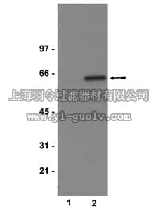 merck millipore,默克密理博,05-669,Anti-phospho-Akt1/PKBα (Ser473) Antibody, clone 11E6