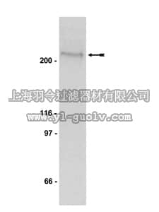 merck millipore,默克密理博,05-673,Anti-phospho-Acetyl CoA Carboxylase (Ser79) Antibody, clone BK102