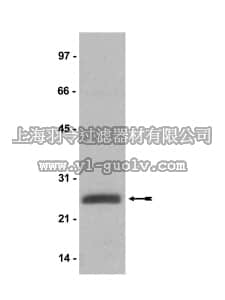 merck millipore,默克密理博,05-678,Anti-ubiquityl-Histone H2A Antibody, clone E6C5