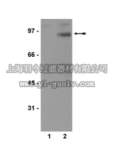 merck millipore,默克密理博,05-694,Anti-phospho-IGF-IR (Tyr1131)/InsR (Tyr1158) Antibody, clone JY202