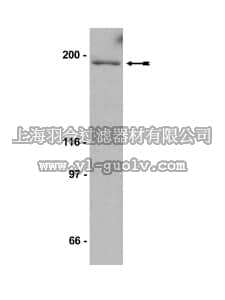 merck millipore,默克密理博,05-696,Anti-Flt-1 Antibody, clone BK302