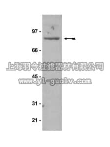 merck millipore,默克密理博,05-704,Anti-ARNT1/HIF-1β Antibody, clone 4G9