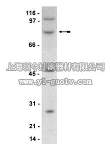 merck millipore,默克密理博,05-733,Anti-SETA/CIN85/Ruk/SH3KBPI Antibody, clone 84