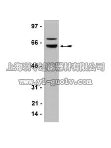 merck millipore,默克密理博,05-753,Anti-WT1 Antibody, clone 6F-H2