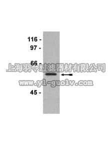 merck millipore,默克密理博,05-771,Anti-Akt2/PKBβ Antibody, clone AW114, rabbit monoclonal