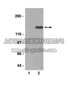 merck millipore,默克密理博,05-774,Anti-phospho-Neurofilament Antibody, medium chain, clone RMO55