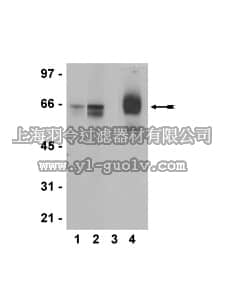 merck millipore,默克密理博,05-793,Anti-phospho-Estrogen Receptor alpha (Ser118) Antibody, clone NL44, rabbit monoclonal