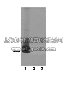 merck millipore,默克密理博,05-799,Anti-Amyloid β (Aβ)x-40 Antibody, clone 11A5-B10