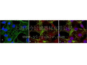 merck millipore,默克密理博,05-802R,Anti-phospho-Akt (Thr308) Antibody, clone 50-1C-25, rabbit monoclonal