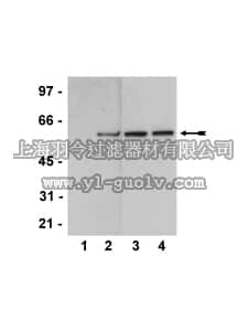 merck millipore,默克密理博,05-802,Anti-phospho-Akt1/PKBα (Thr308) Antibody, clone NL50, rabbit monoclonal