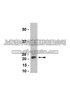 merck millipore,默克密理博,05-812,Anti-NY-ESO-1 Antibody, clone E978