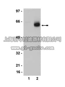 merck millipore,默克密理博,05-824,Anti-Estrogen Receptor β Antibody, clone 68-4, rabbit monoclonal