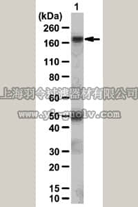 merck millipore,默克密理博,05-825R,Anti-PDGFR-β Antibody, clone 4A56, rabbit monoclonal