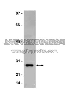 merck millipore,默克密理博,05-826,Anti-Bcl-2 Antibody, clone AW604