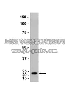 merck millipore,默克密理博,05-828,Anti-DJ-1 Antibody, clone E.2