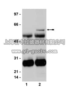 merck millipore,默克密理博,05-837,Anti-HFH-4/FOXJ1 Antibody, clone 3-19