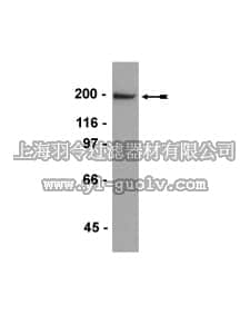 merck millipore,默克密理博,05-848,Anti-Neurofilament Antibody, heavy chain, KEP segment, clone 3G3