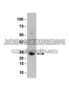 merck millipore,默克密理博,05-853,Anti-Rab11 Antibody, clone 47