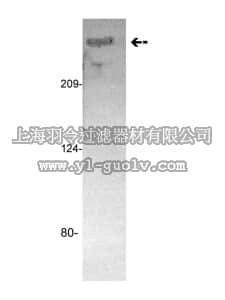 merck millipore,默克密理博,05-859,Anti-Fibrinogen Antibody, clone GMA-035