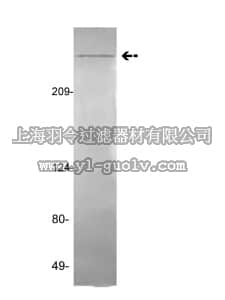 merck millipore,默克密理博,05-861,Anti-vWF (von Willebrand Factor) Antibody, clone GMA-022