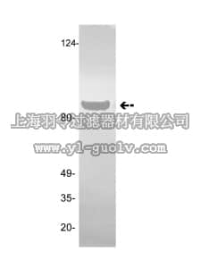merck millipore,默克密理博,05-862,Anti-Plasminogen/Angiostatin Antibody, clone GMA-013