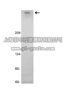 merck millipore,默克密理博,05-871,Anti-Factor VIII Antibody, clone GMA-012