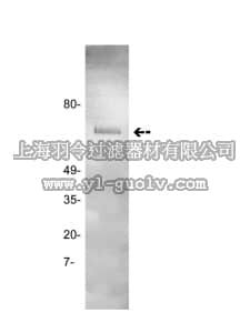 merck millipore,默克密理博,05-879,Anti-Prothrombin Antibody, clone GMA-095