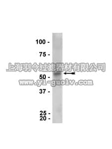 merck millipore,默克密理博,05-882,Anti-Parkin Antibody, clone PRK8