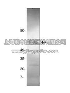 merck millipore,默克密理博,05-883,Anti-tPA (Tissue Plasminogen Activator) Antibody, clone GMA-043
