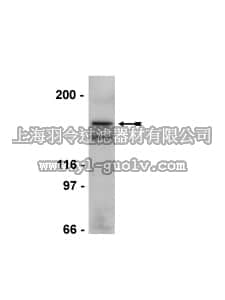 merck millipore,默克密理博,05-897,Anti-HDAC9 Antibody, clone LH/JC2