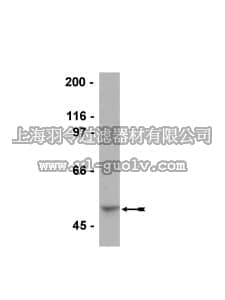 merck millipore,默克密理博,05-909,Anti-AP-2γ Antibody, clone 6E4/4