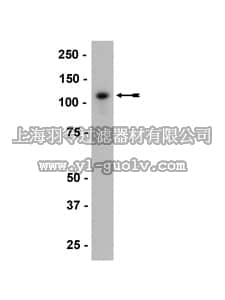merck millipore,默克密理博,05-916,Anti-P-Cadherin Antibody, clone 6A9