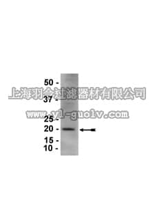merck millipore,默克密理博,05-929,Anti-p19ARF Antibody, clone 5-C3-1