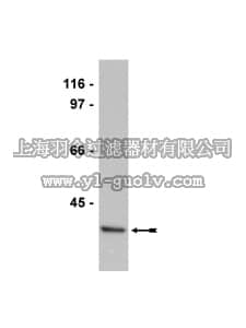 merck millipore,默克密理博,05-941,Anti-PTPA Antibody, clone 5G3