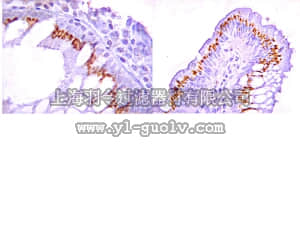 merck millipore,默克密理博,06-018,Anti-ROR2 Antibody, CT