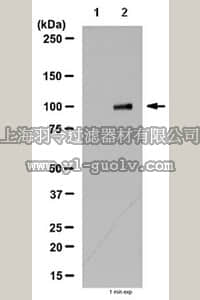 merck millipore,默克密理博,06-1040,Anti-RIG-I (NT) Antibody