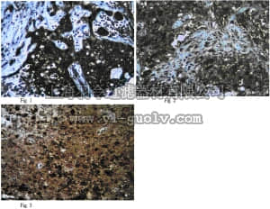merck millipore,默克密理博,06-1050,Anti-Axin-2 Antibody
