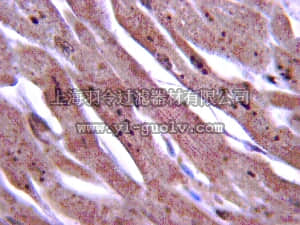 merck millipore,默克密理博,06-1087,Anti-DKK2 Antibody