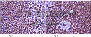 merck millipore,默克密理博,06-1089,Anti-IL-12R-beta-1 Antibody