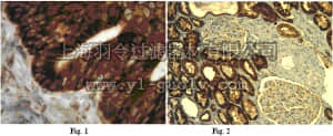 merck millipore,默克密理博,06-1091,Anti-IL-13 receptor Antibody, alpha-2 (IL-13RA2)