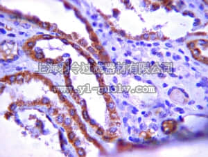 merck millipore,默克密理博,06-1102,Anti-Protein patched homolog 1 Antibody