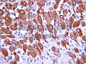 merck millipore,默克密理博,06-1103,Anti-Protein patched homolog 2 Antibody
