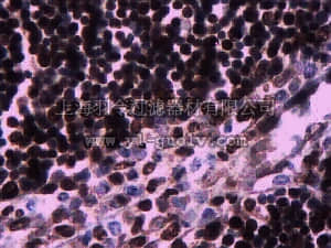 merck millipore,默克密理博,06-1116,Anti-IL-33R ST2 (IL1RL1) Antibody