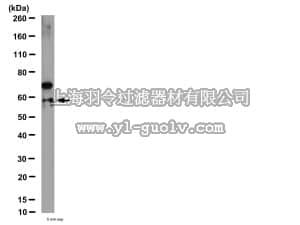 merck millipore,默克密理博,06-114,Anti-Cathepsin D Antibody